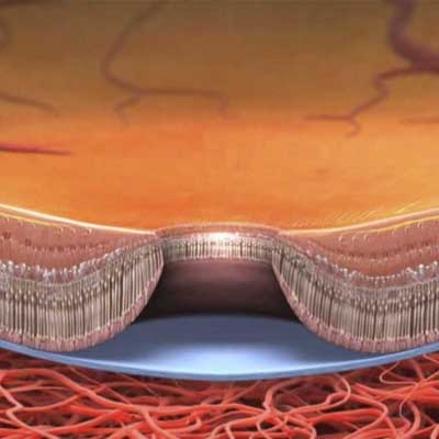 Agujero macular. Enfermedades y tratamientos para los problemas oculares por el Instituto Oftalmológico Recoletas.