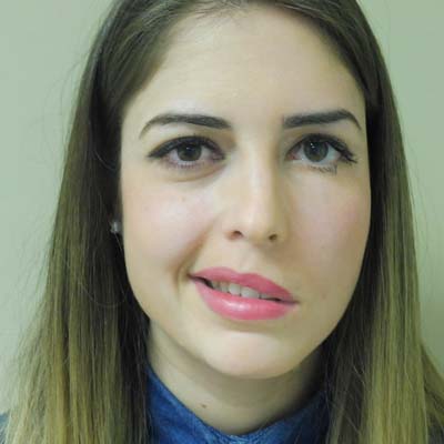Parálisis Facial. Enfermedades y tratamientos para los problemas oculares por el Instituto Oftalmológico Recoletas.