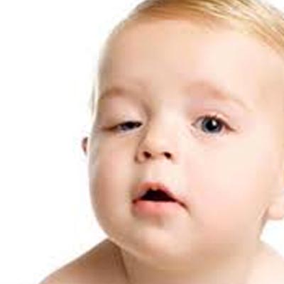 Ptosis Palpebral Infantil. Enfermedades y tratamientos para los problemas oculares por el Instituto Oftalmológico Recoletas.