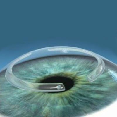 Agujero macular IOR Instituto oftalmológico
