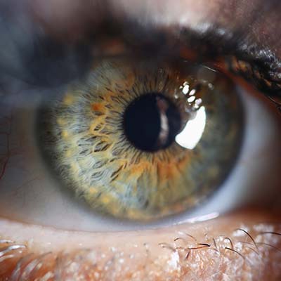 Agujero macular IOR Instituto oftalmológico