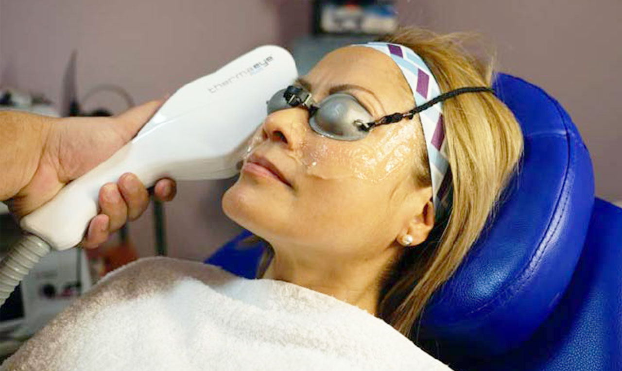 Luz pulsada IPL. Medicina Estética Periocular. IOR