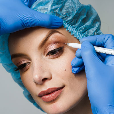 blefaroplastia. Instituto Oftalmológico Recoletas