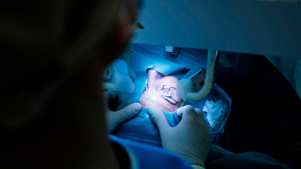 ¿Sabías que no existe ninguna alternativa a la cirugía ocular en el caso de un desprendimiento de retina?