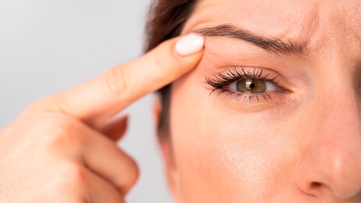 ¿Cuándo realizar una blefaroplastia?