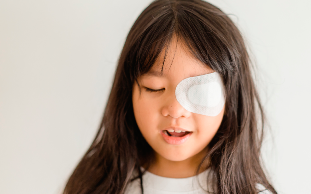 ¿Qué sabes del ojo vago?