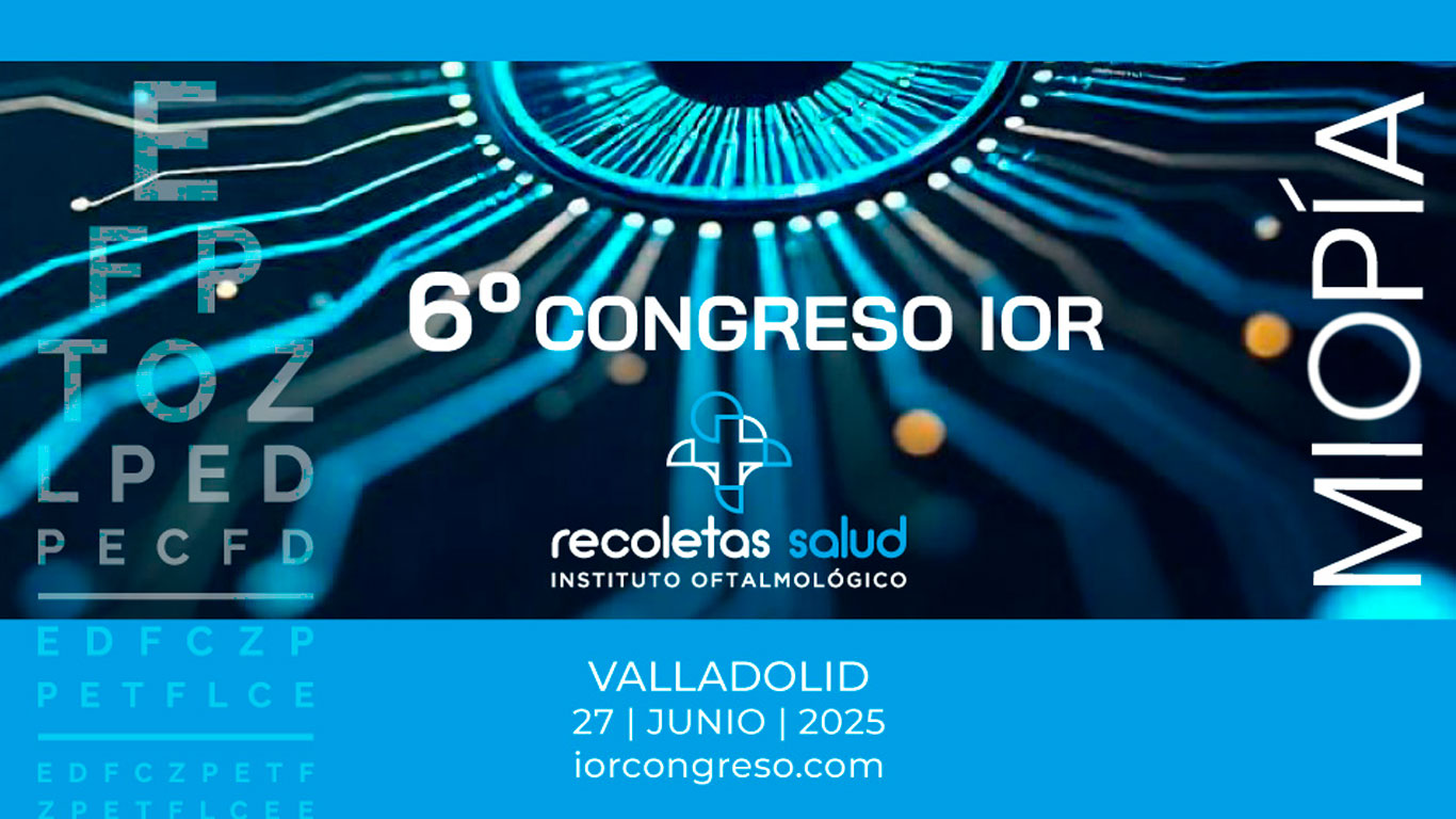 El Sexto Congreso del Instituto Oftalmológico Recoletas Salud abordará de forma monográfica la miopía